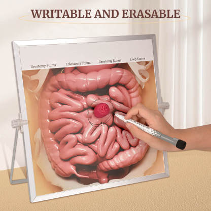 Ostomy Model Kit for Stoma Care Teaching