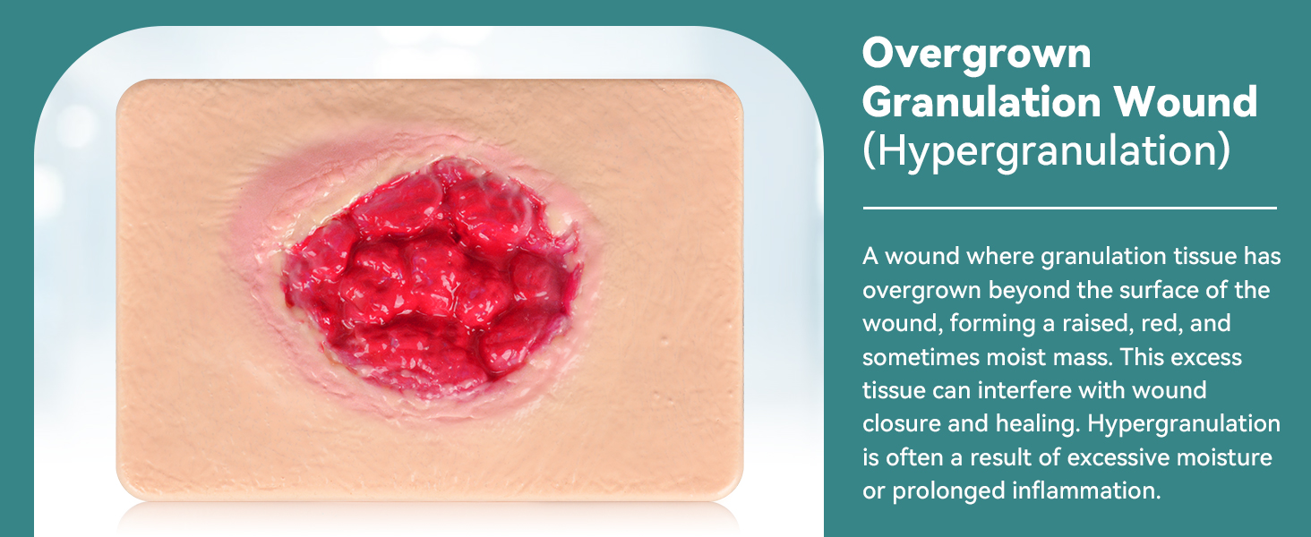 Overgrown Grannulation Wound Model