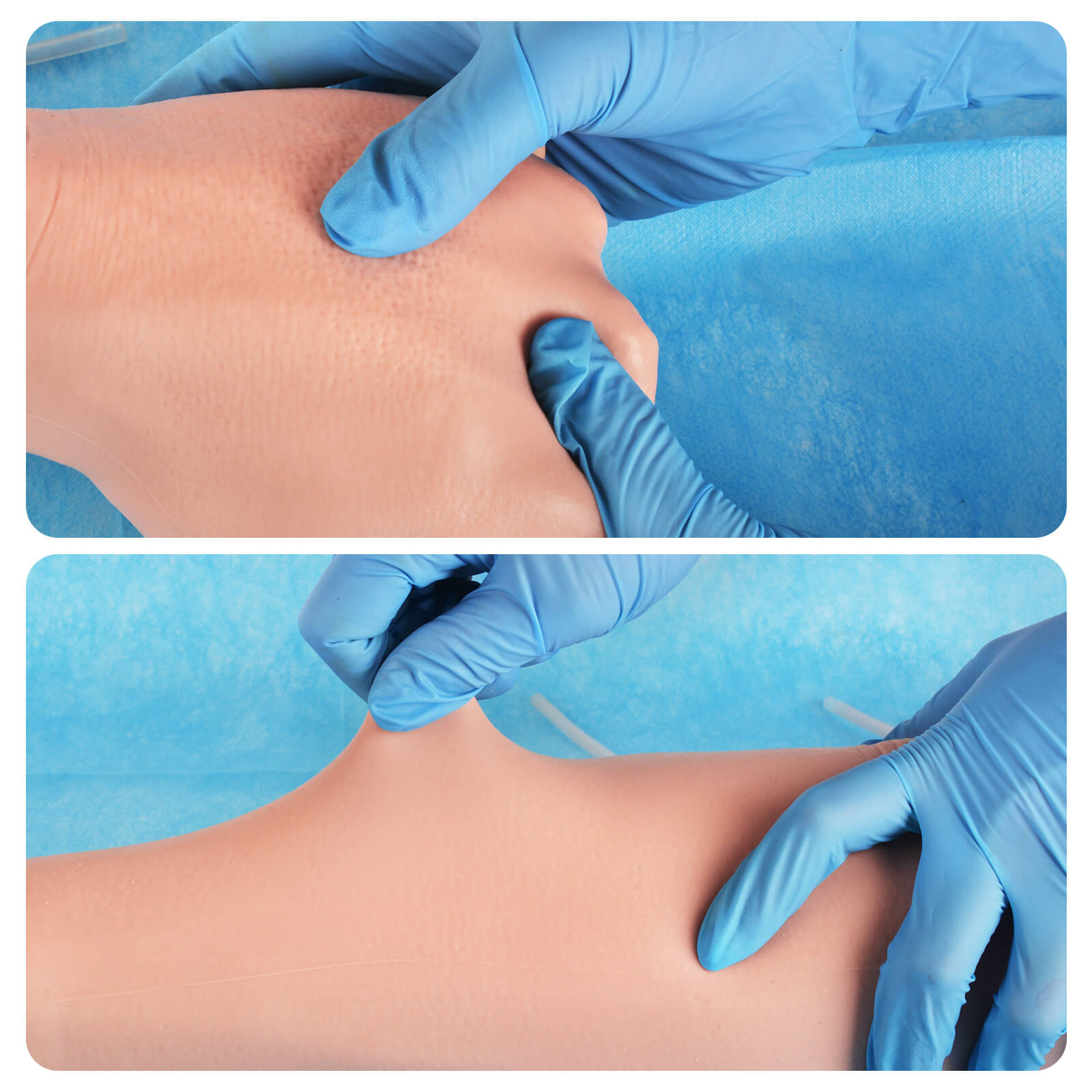 Phlebotomy Practice Arm with Replaceable Skin & Veins