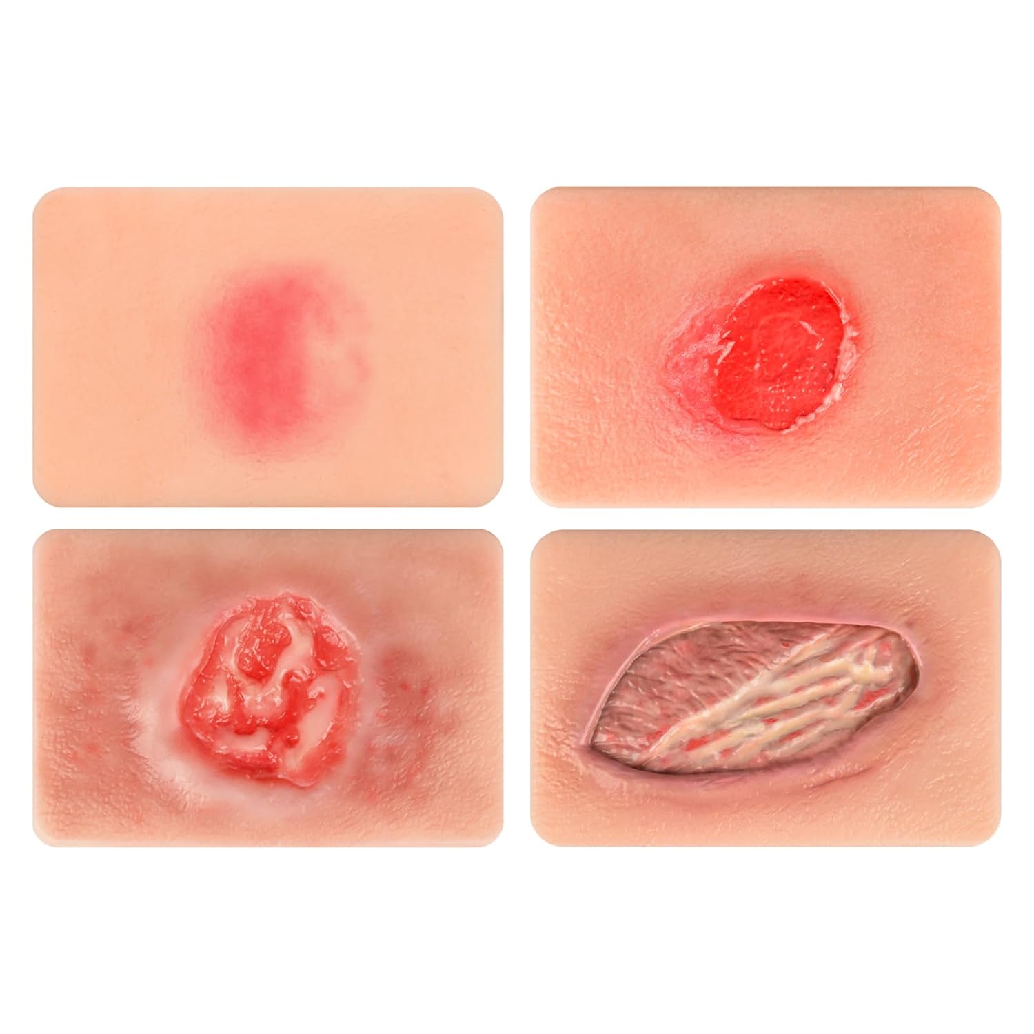 Handheld Pressure Ulcer Wound Simulation Models (Stage 1-4)