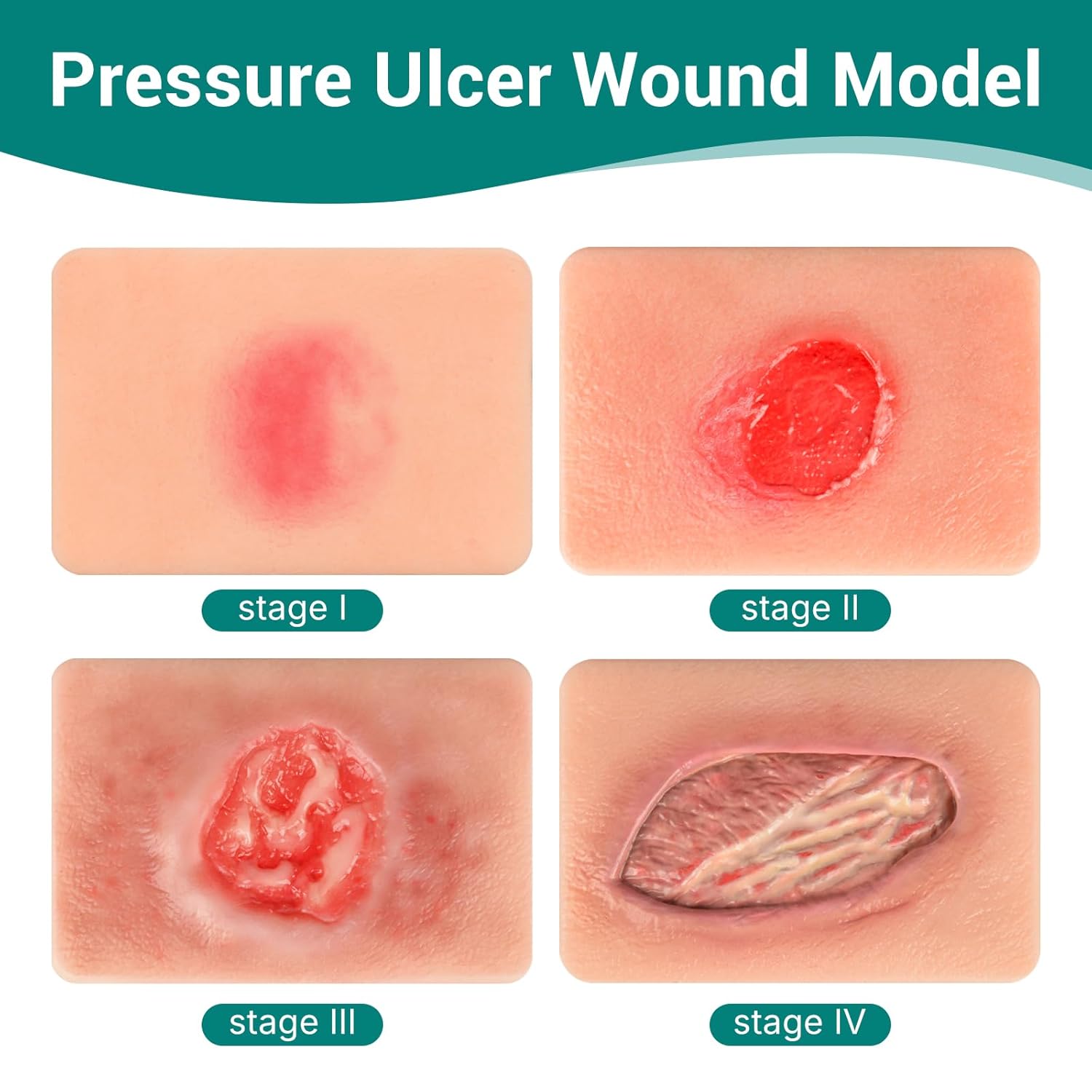 Handheld Pressure Ulcer Wound Simulation Models (Stage 1-4)