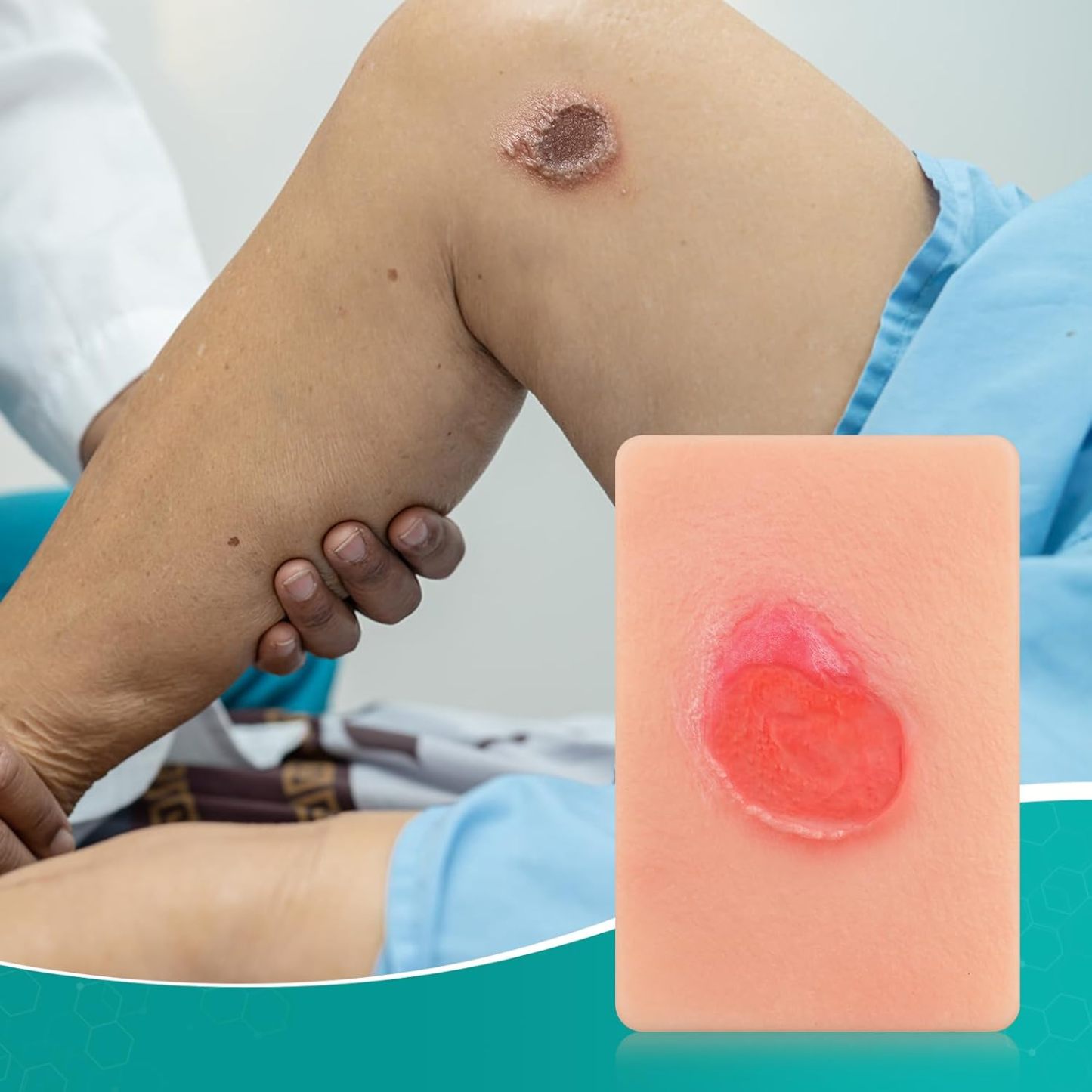 Handheld Pressure Ulcer Wound Simulation Models (Stage 1-4)