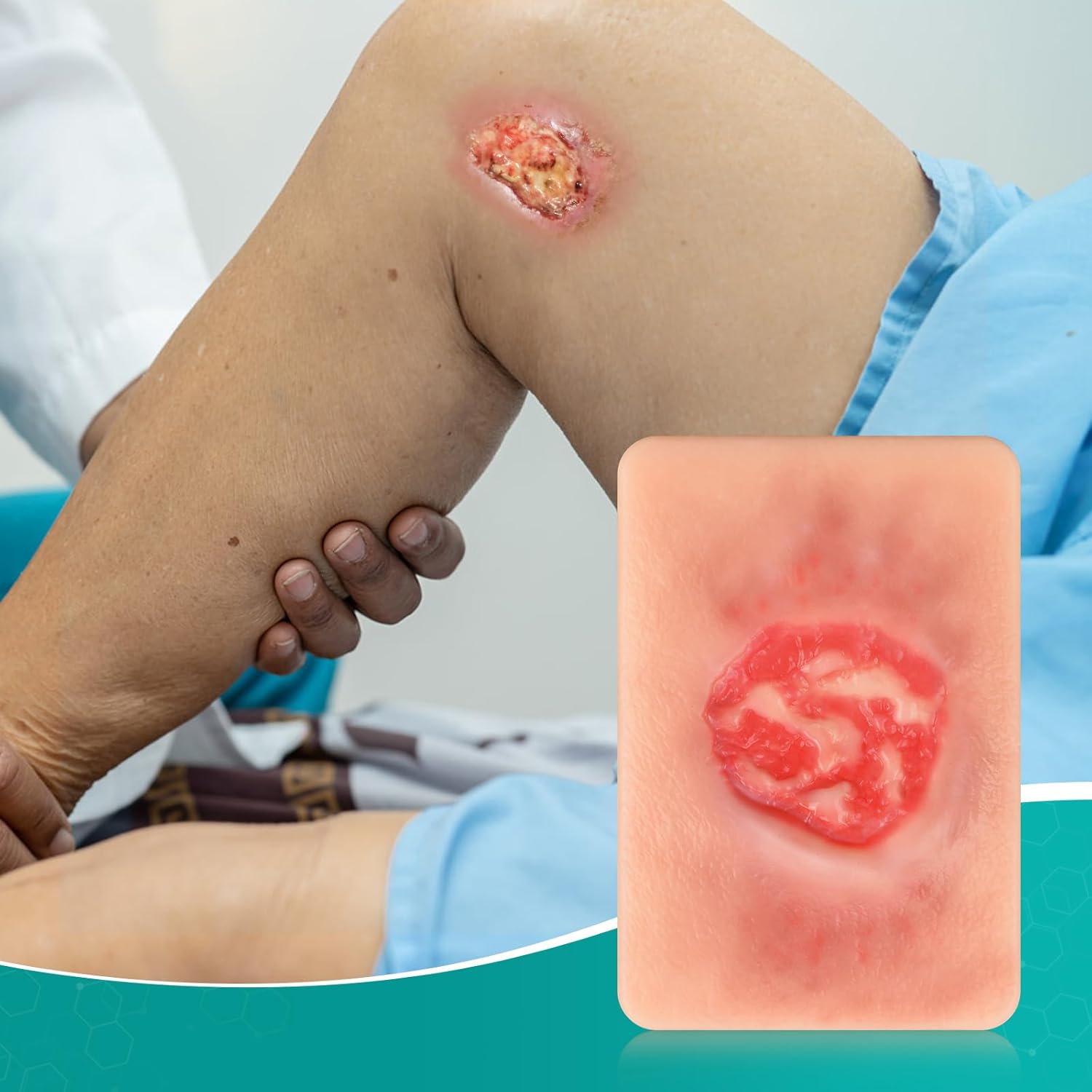 Handheld Pressure Ulcer Wound Simulation Models (Stage 1-4)