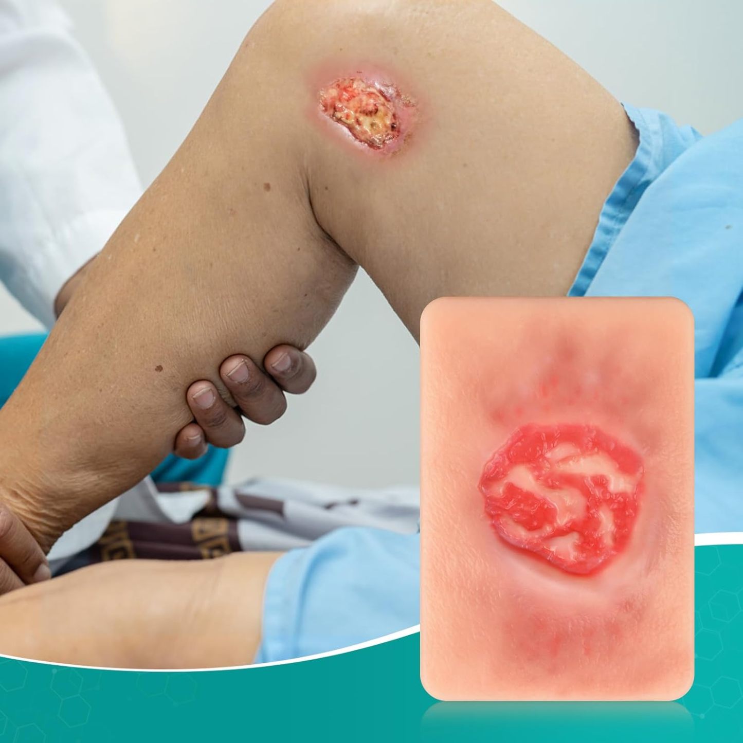 Handheld Pressure Ulcer Wound Simulation Models (Stage 1-4)