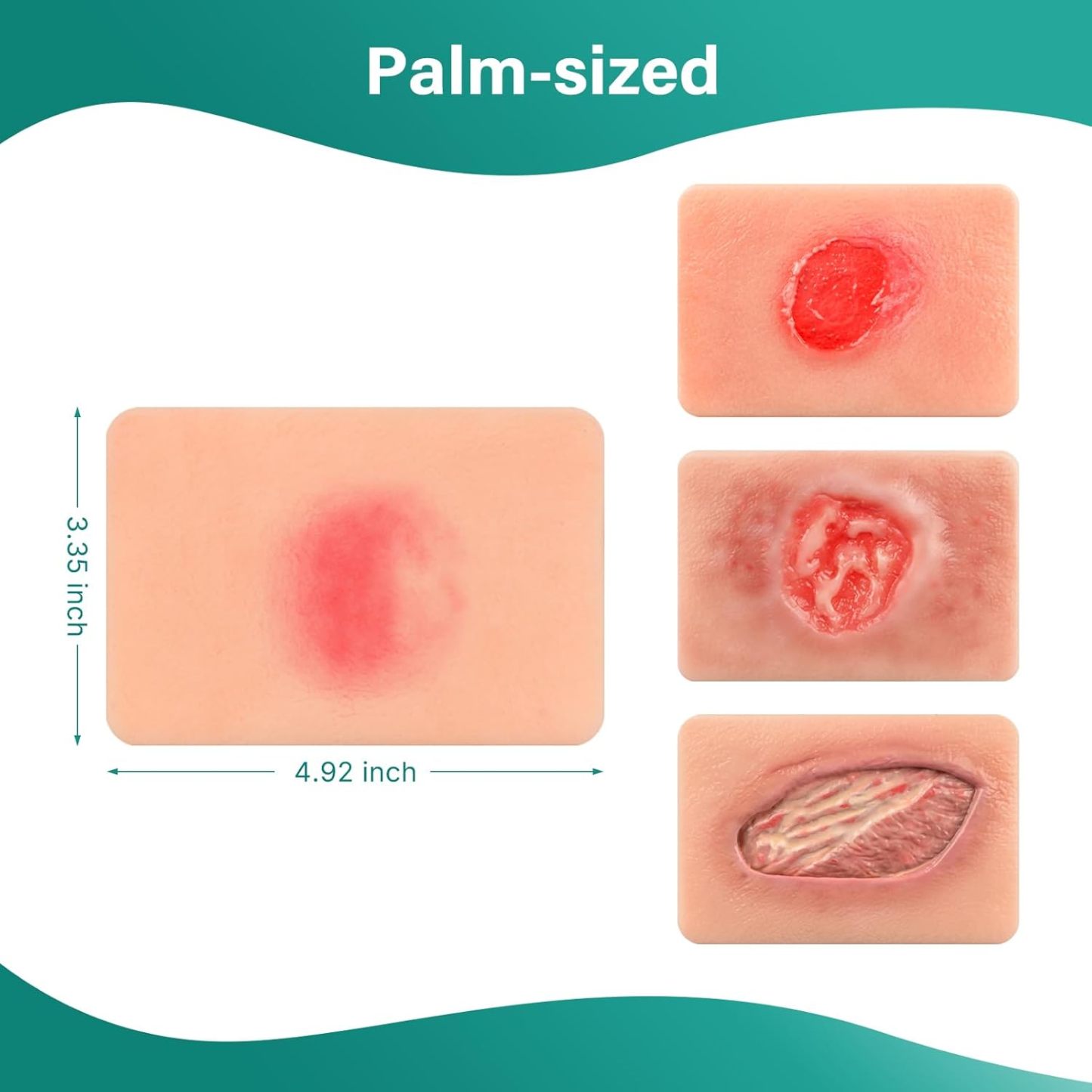 Handheld Pressure Ulcer Wound Simulation Models (Stage 1-4)
