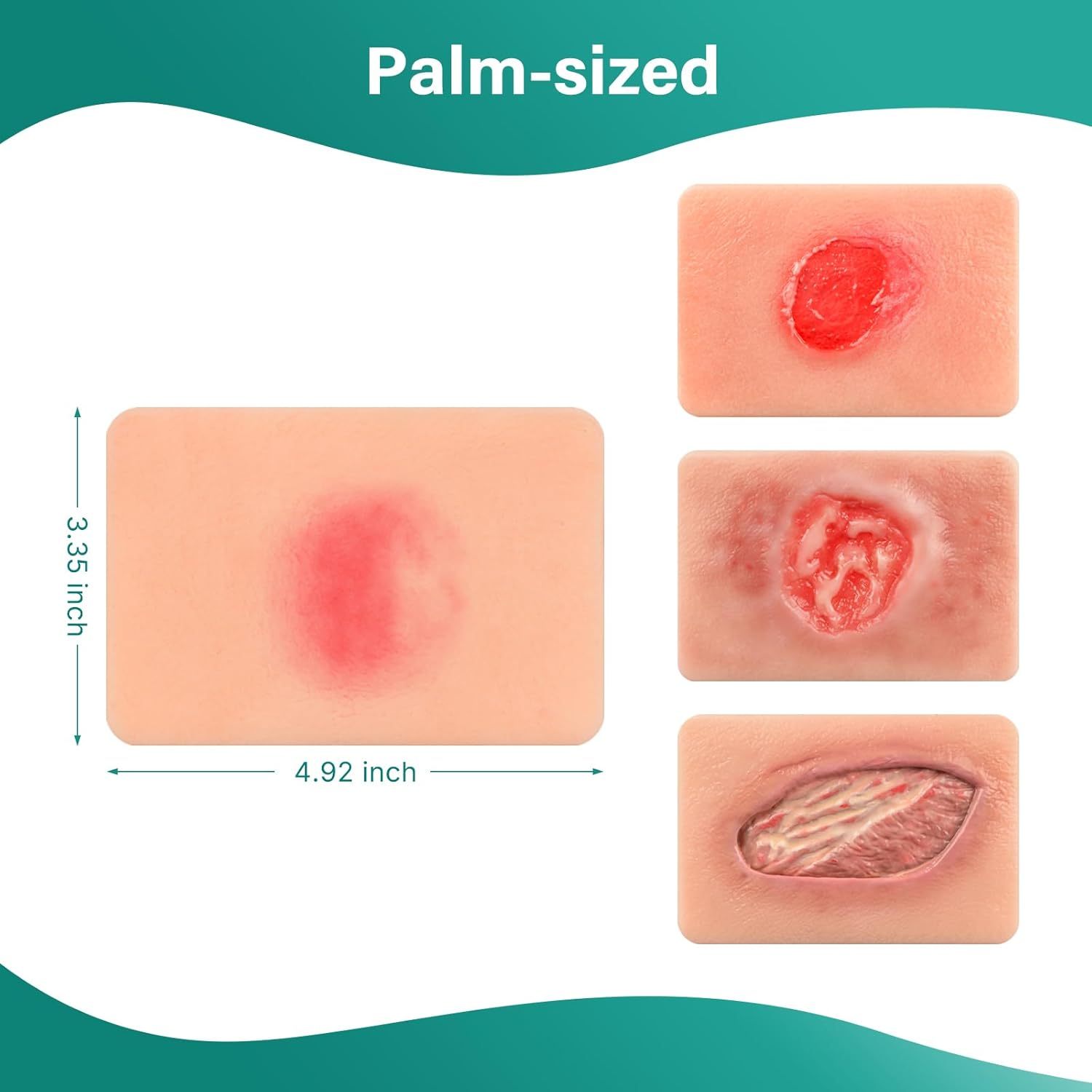 Handheld Pressure Ulcer Wound Simulation Models (Stage 1-4)