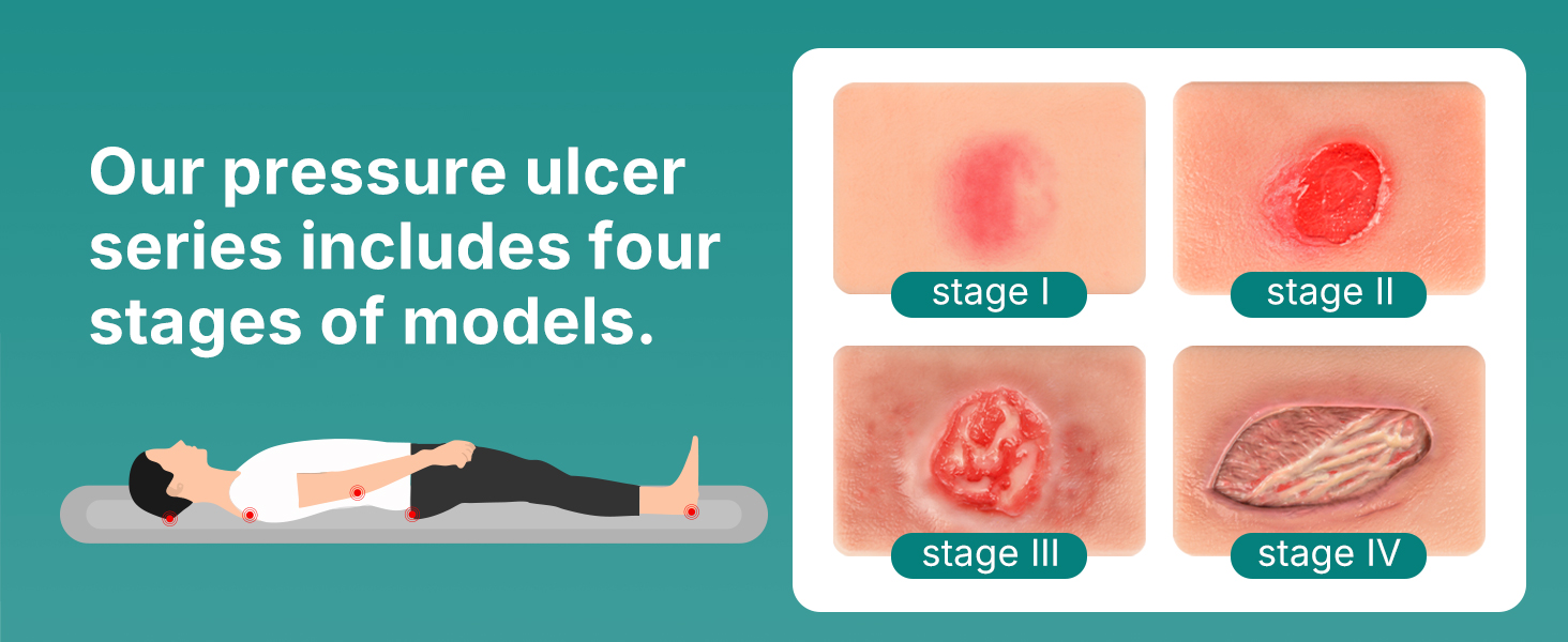 Handheld Pressure Ulcer Wound Simulation Models 