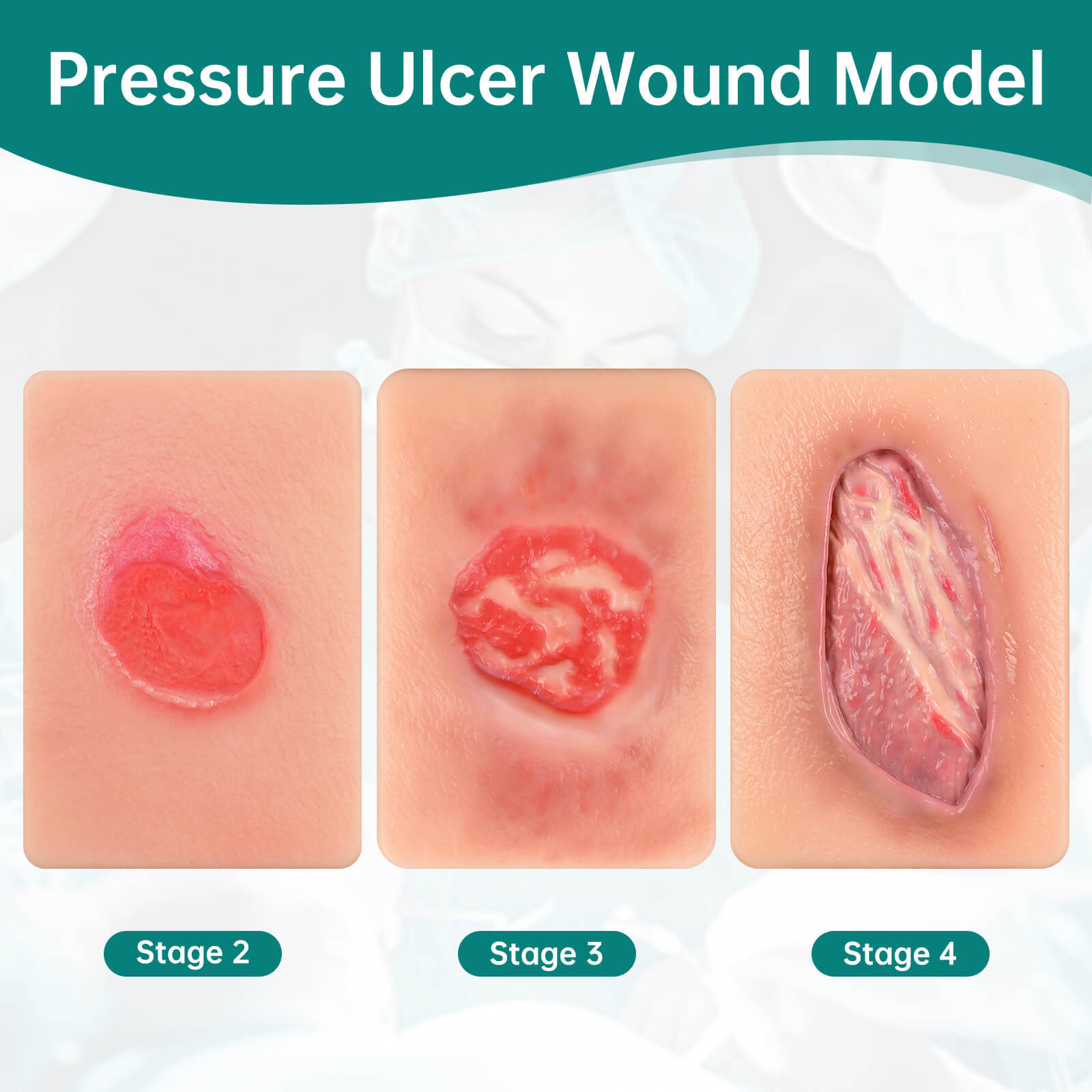 Card-Sized Pressure Ulcer Wound Models (Stage 2, 3, 4)