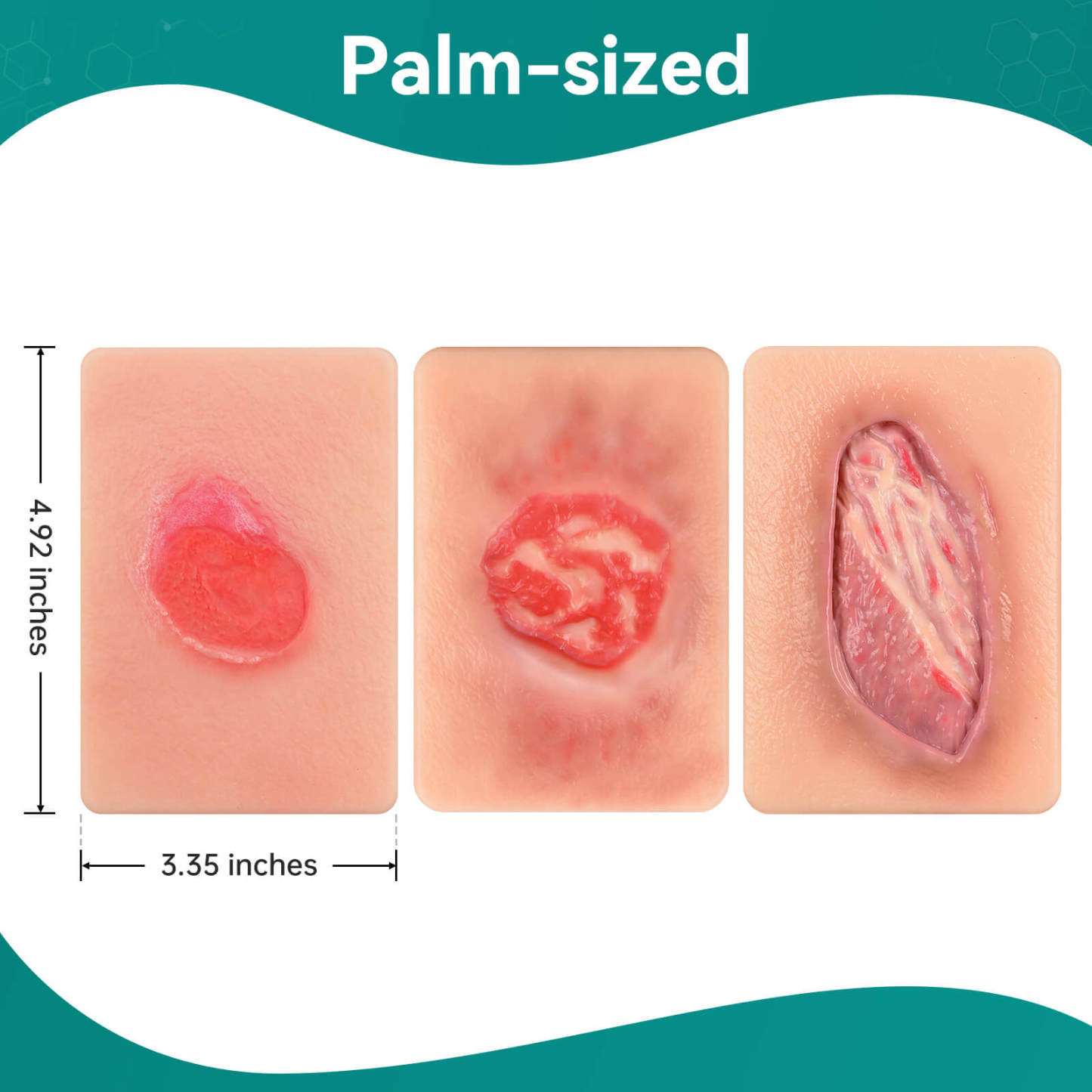 Card-Sized Pressure Ulcer Wound Models (Stage 2, 3, 4)