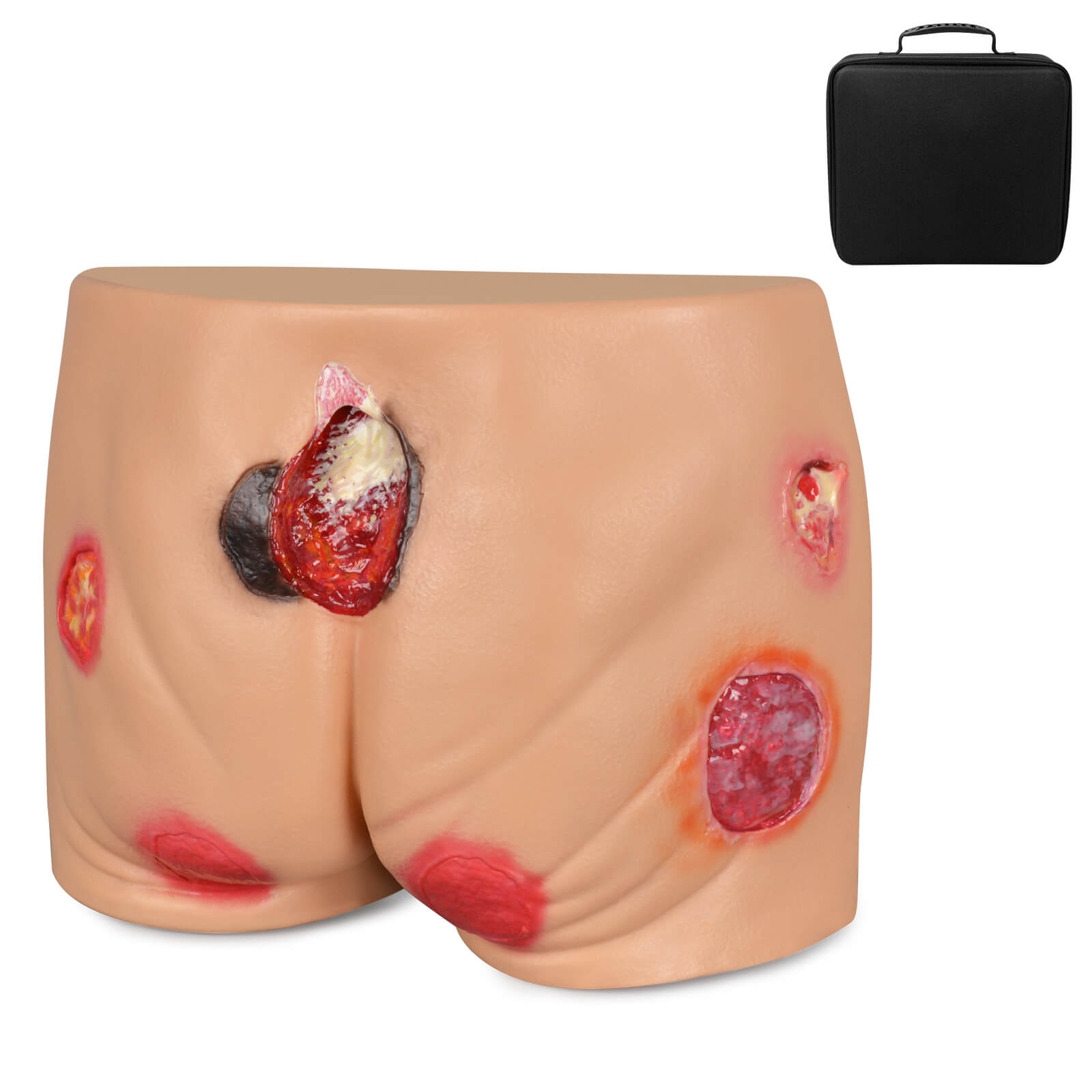 PVC Buttock Decubitus Ulcer Model with Multi-Stage Ulcer Simulation