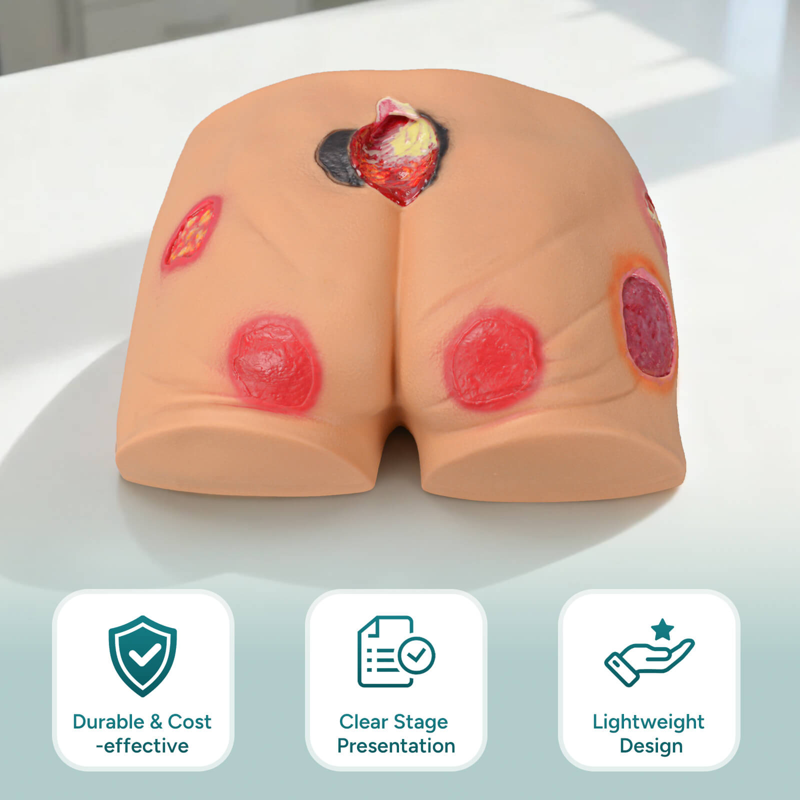 PVC Buttock Decubitus Ulcer Model with Multi-Stage Ulcer Simulation