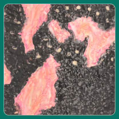 Severe Leg Burn Wound Care Trainer 