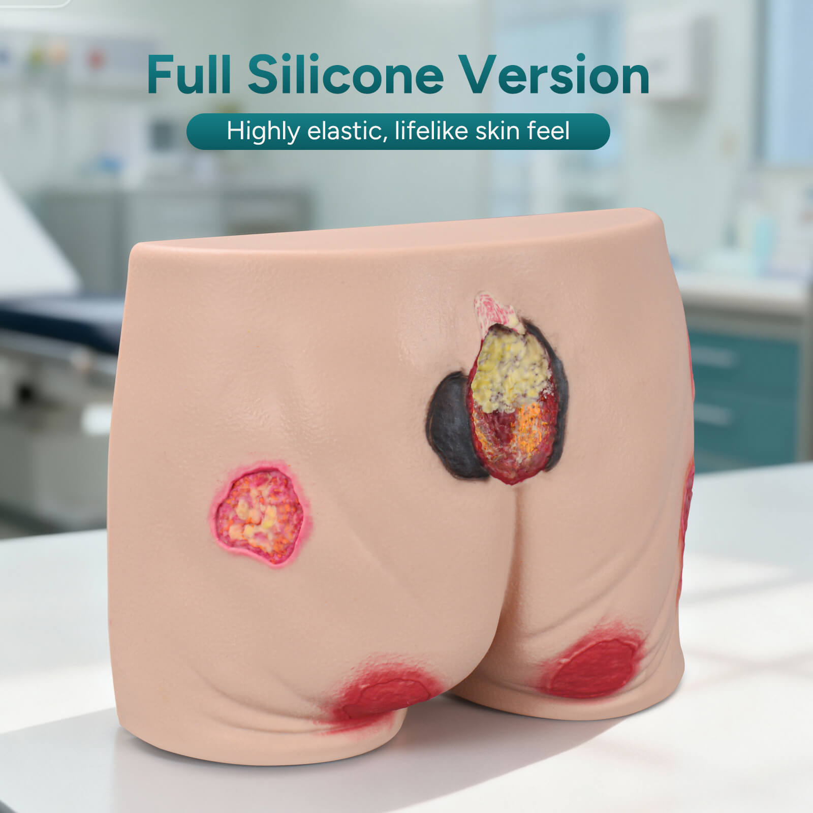 Silicone Buttock Pressure Ulcer Model with Multi-Stage Ulcer Simulation