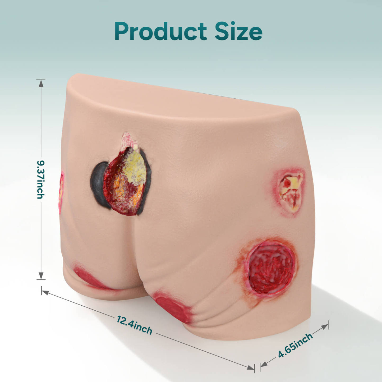 Silicone Buttock Pressure Ulcer Model with Multi-Stage Ulcer Simulation