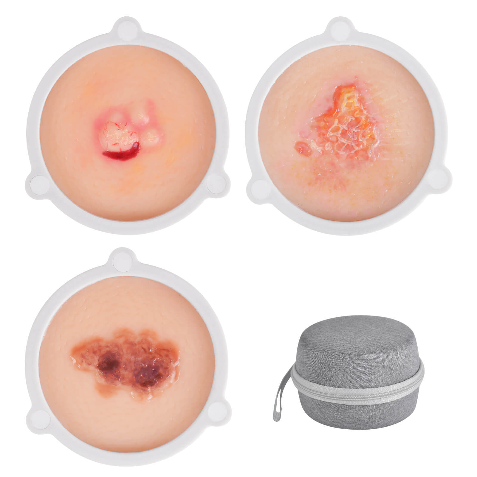 Skin Cancer Model for Medical & Dermatology Training