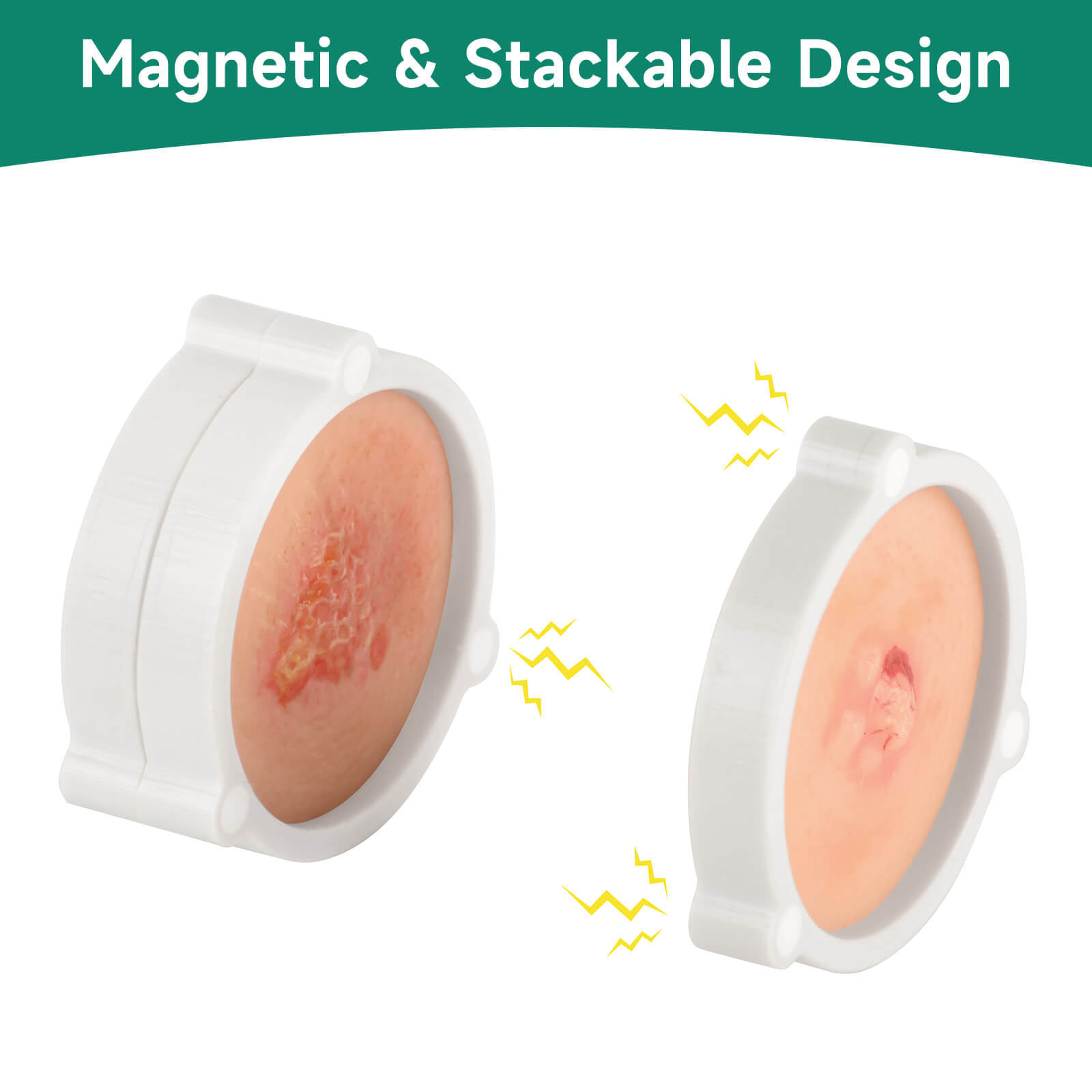 Skin Cancer Model for Medical & Dermatology Training