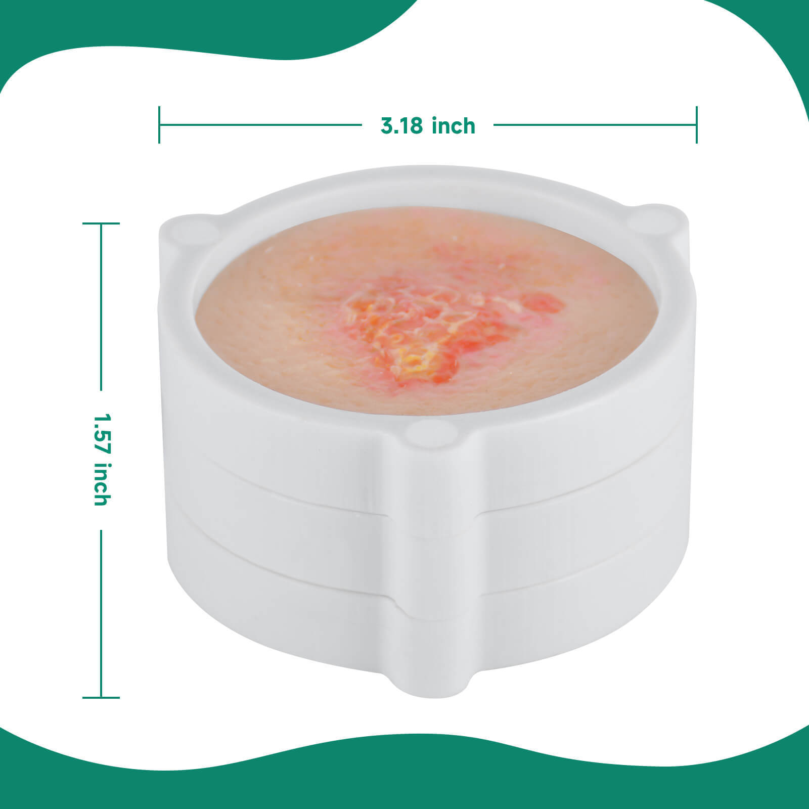 Skin Cancer Model for Medical & Dermatology Training