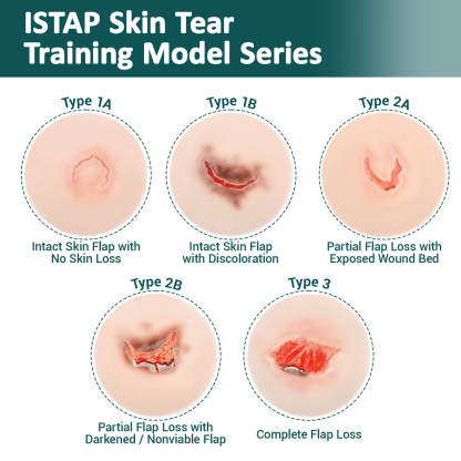Adhesive Skin Tear Wound Moulage