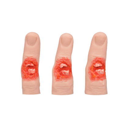 Slip-On Finger Fracture Wound Trainer (Set of 3 Sizes)