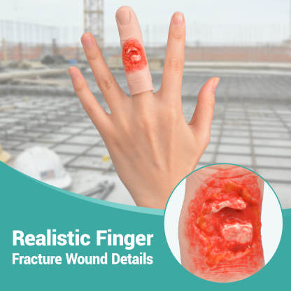 Slip-On Finger Fracture Wound Simulator with Realistic Details