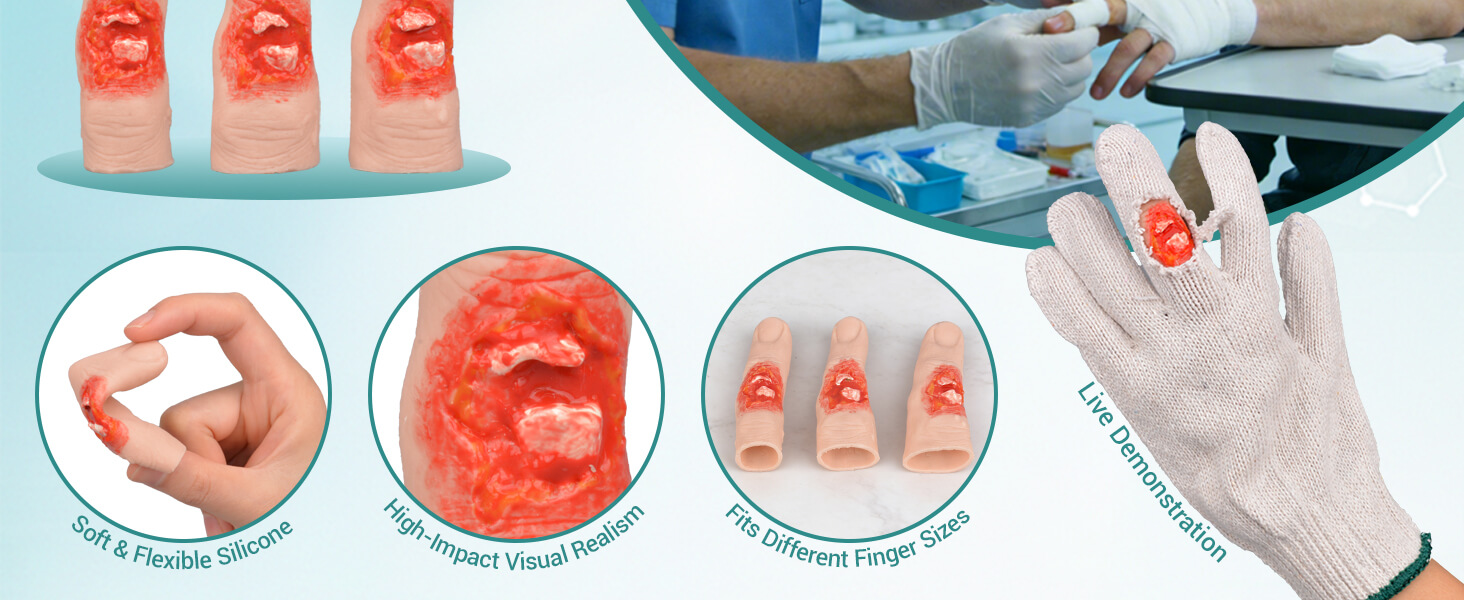 Realistic Finger Fracture Wound Simulator (Set of 3 Sizes)