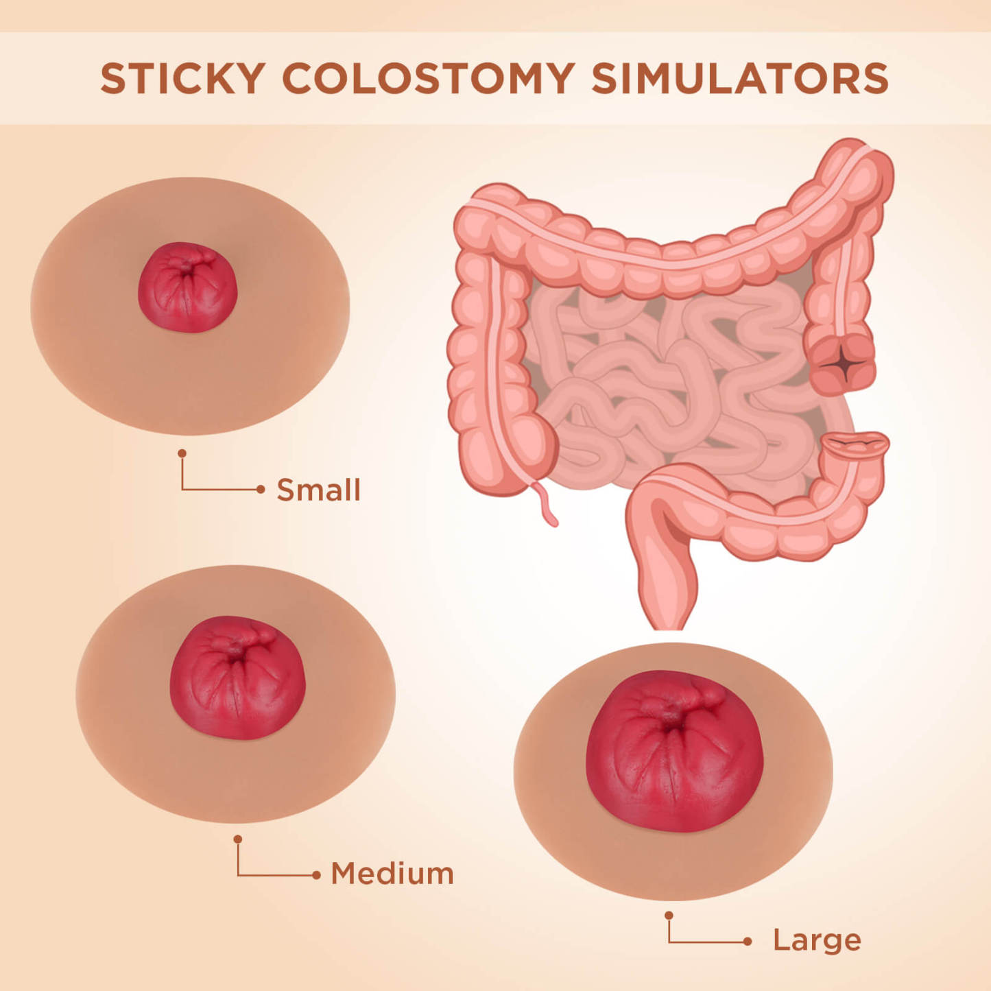 Sticky Colostomy Care Simulators, Tan Skin Tone