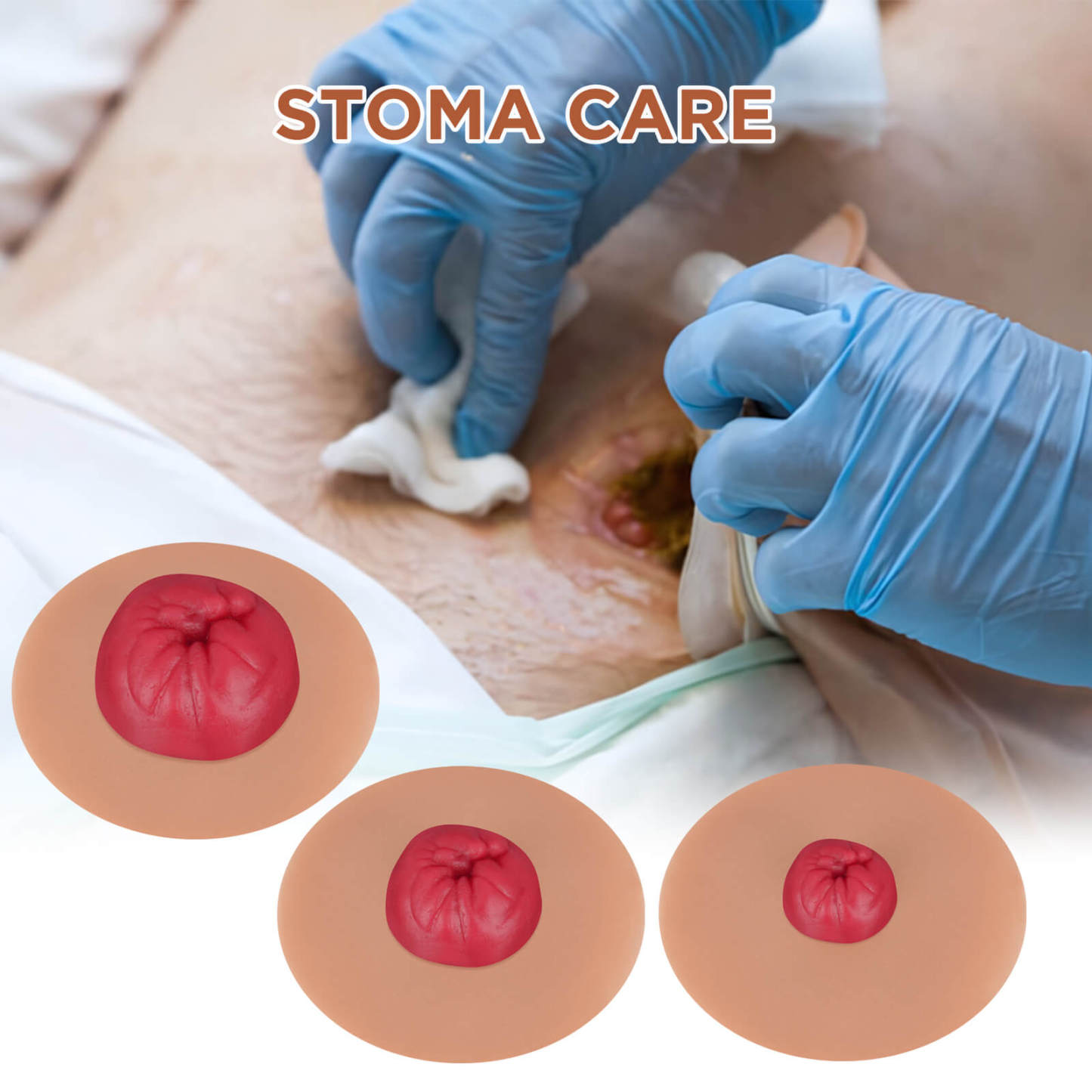 Sticky Colostomy Care Simulators, Tan Skin Tone