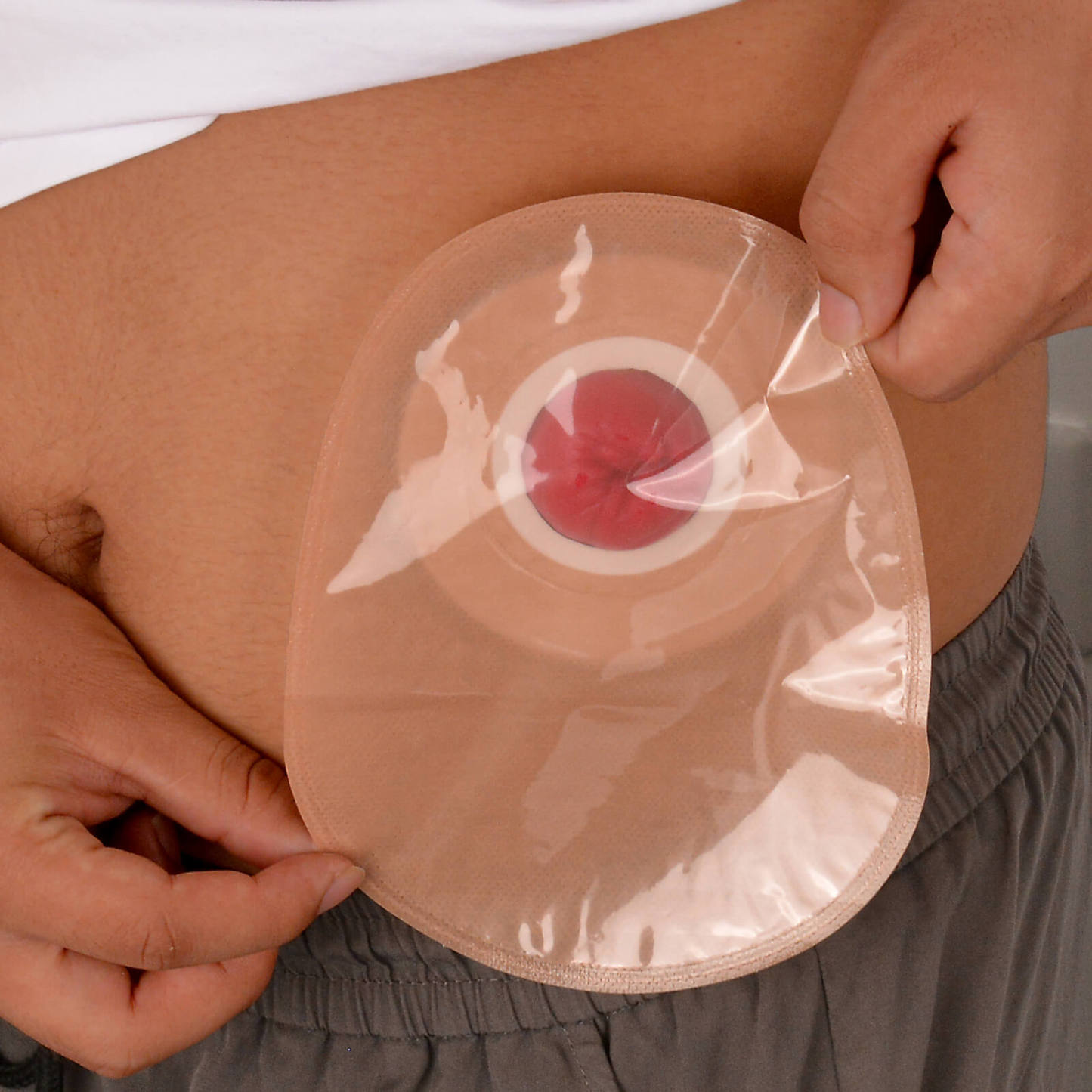 Sticky Colostomy Care Simulators, Tan Skin Tone