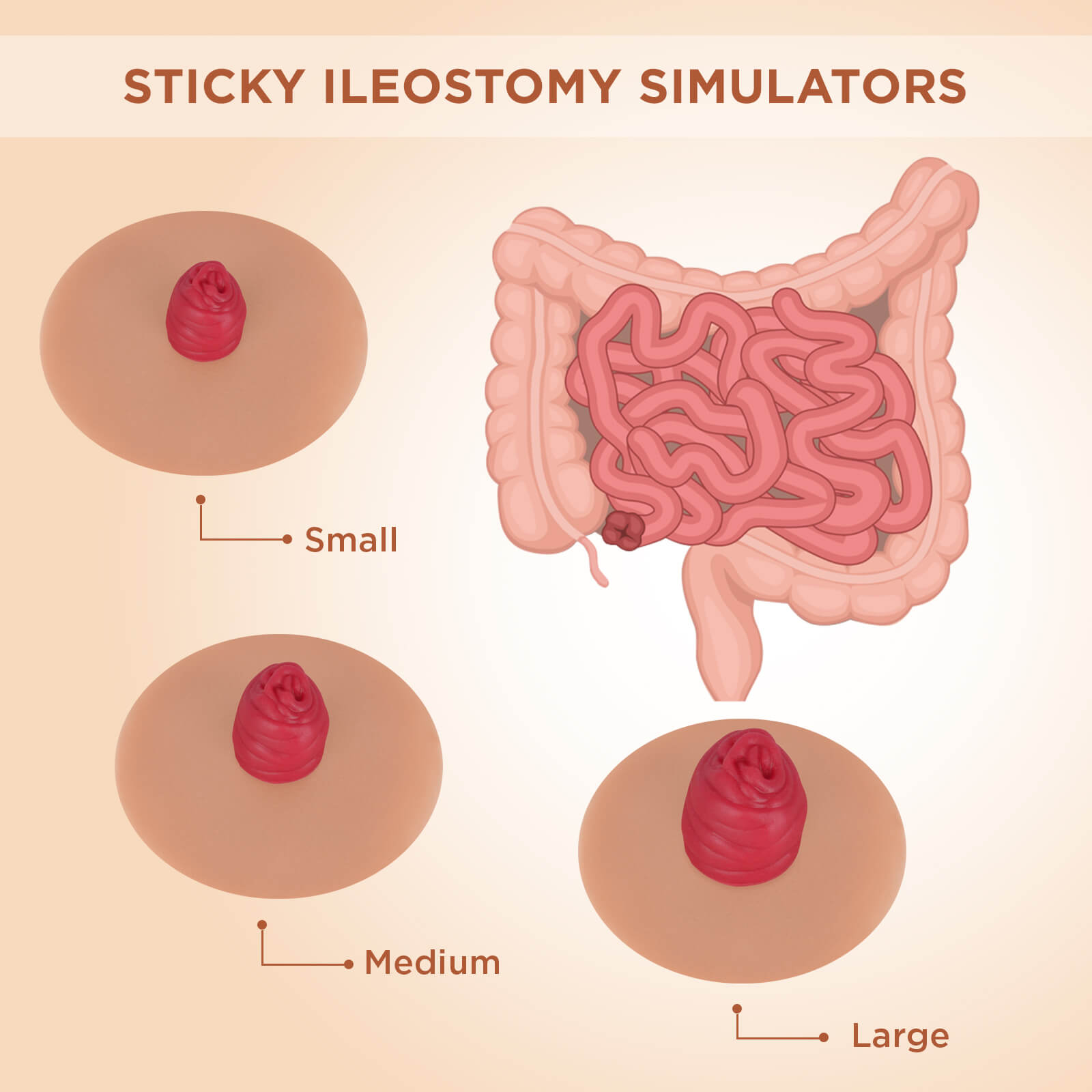 Sticky Ileostomy Stoma Training Models, Tan Skin