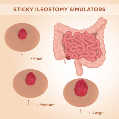 Sticky Ileostomy Stoma Training Models, Tan Skin
