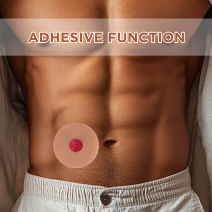 Sticky Ileostomy Stoma Training Models, Tan Skin