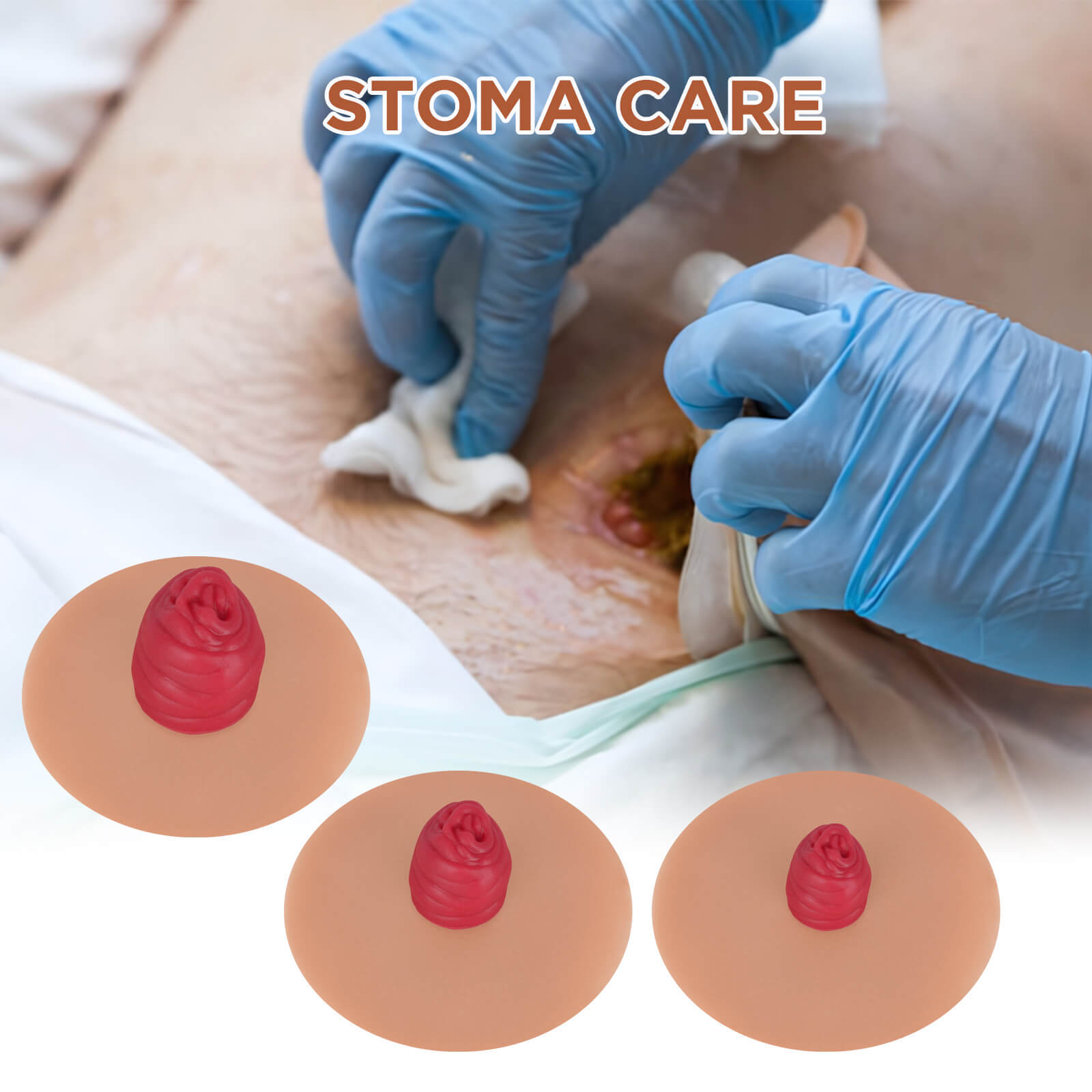 Sticky Ileostomy Stoma Training Models, Tan Skin