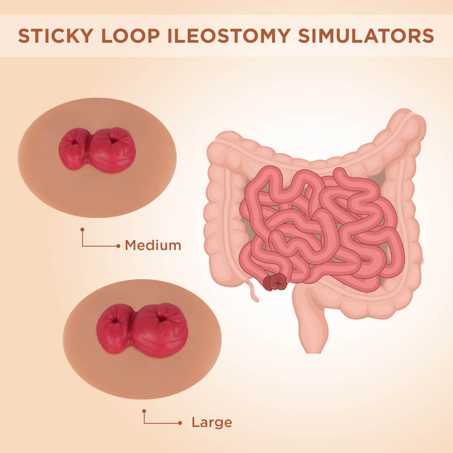Sticky Loop Ileostomy Stoma Care Simulators, Tan Skin