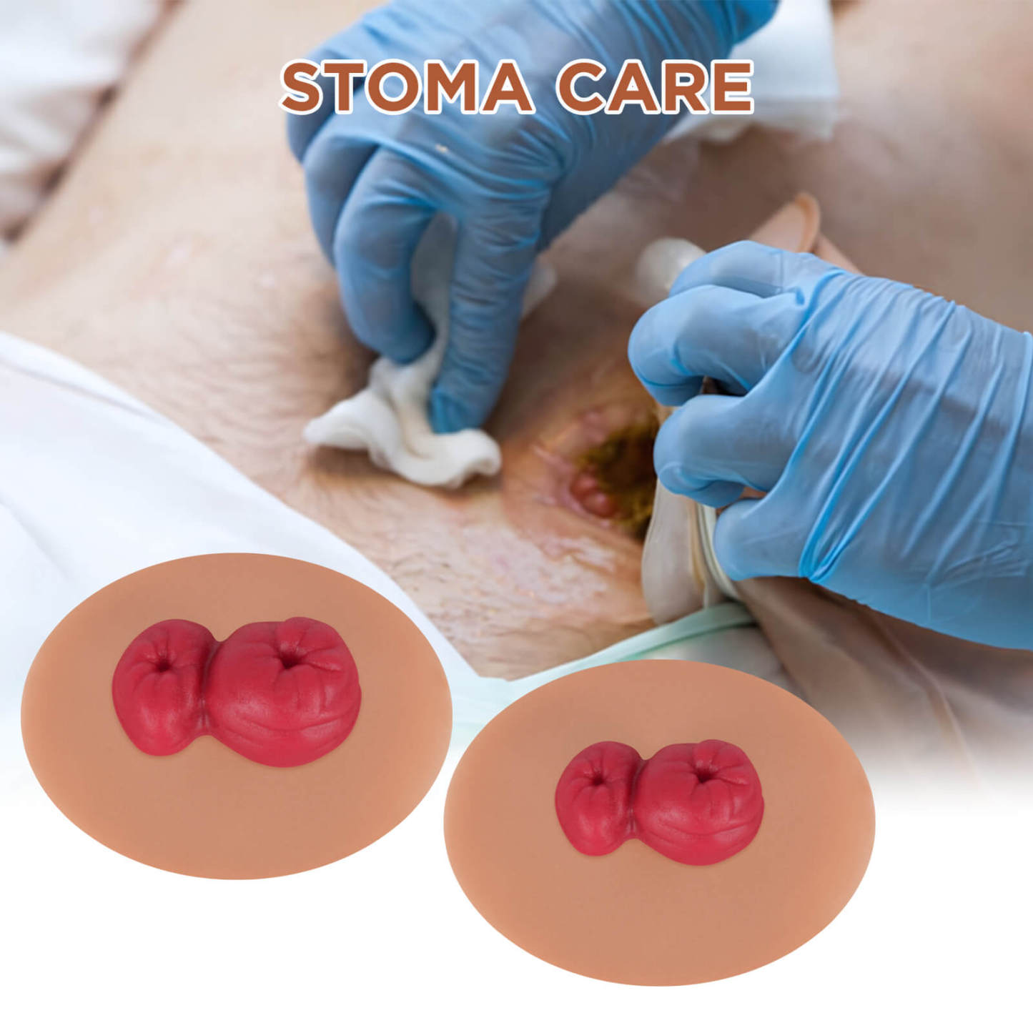Sticky Loop Ileostomy Stoma Care Simulators, Tan Skin