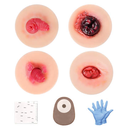 Sticky Stoma Complications Simulation Models Set