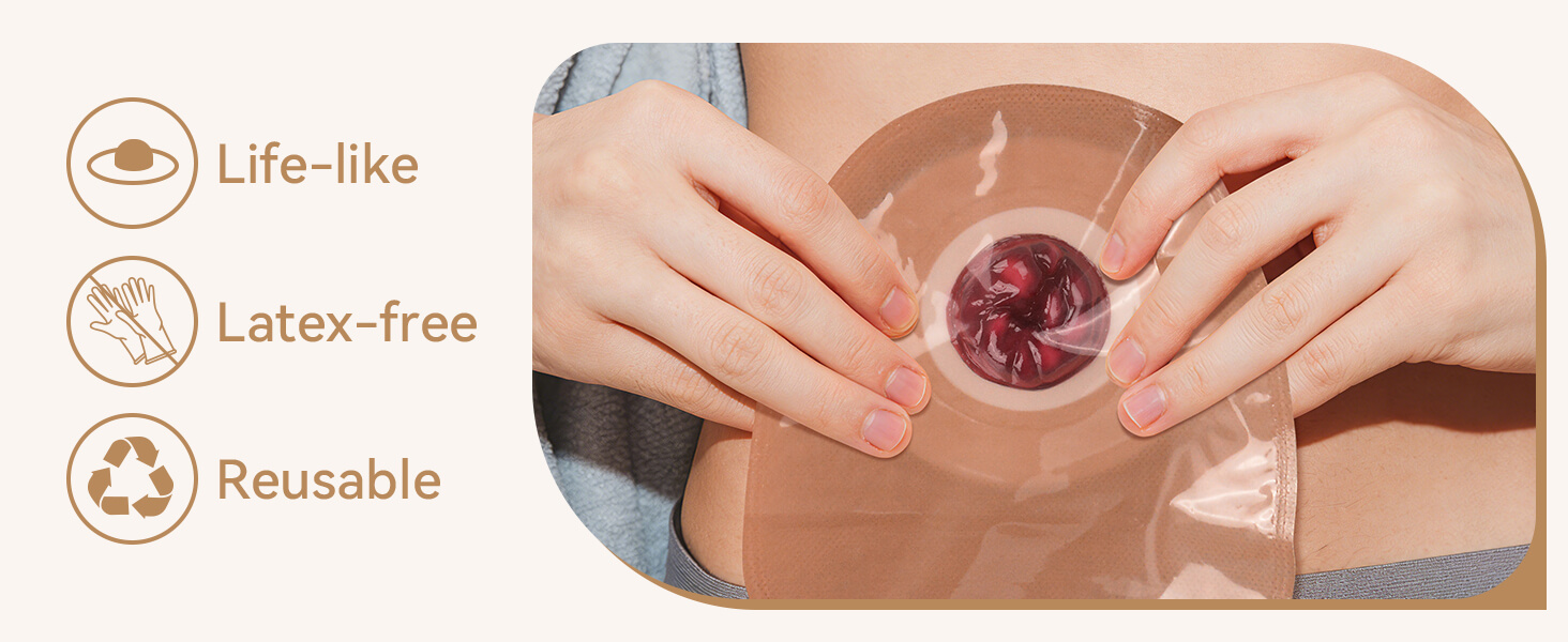 Sticky Stoma Complications Simulation Models for Ostomy Care Training