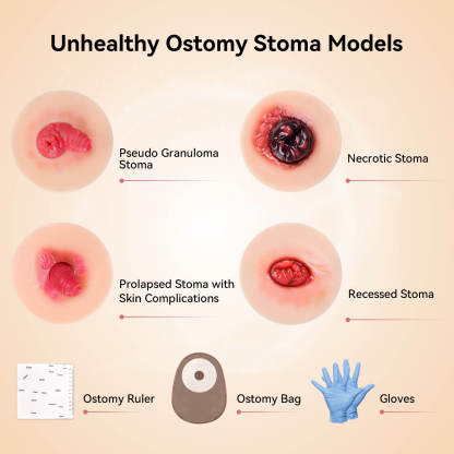 Sticky Unhealthy Stoma Simulation Models Set
