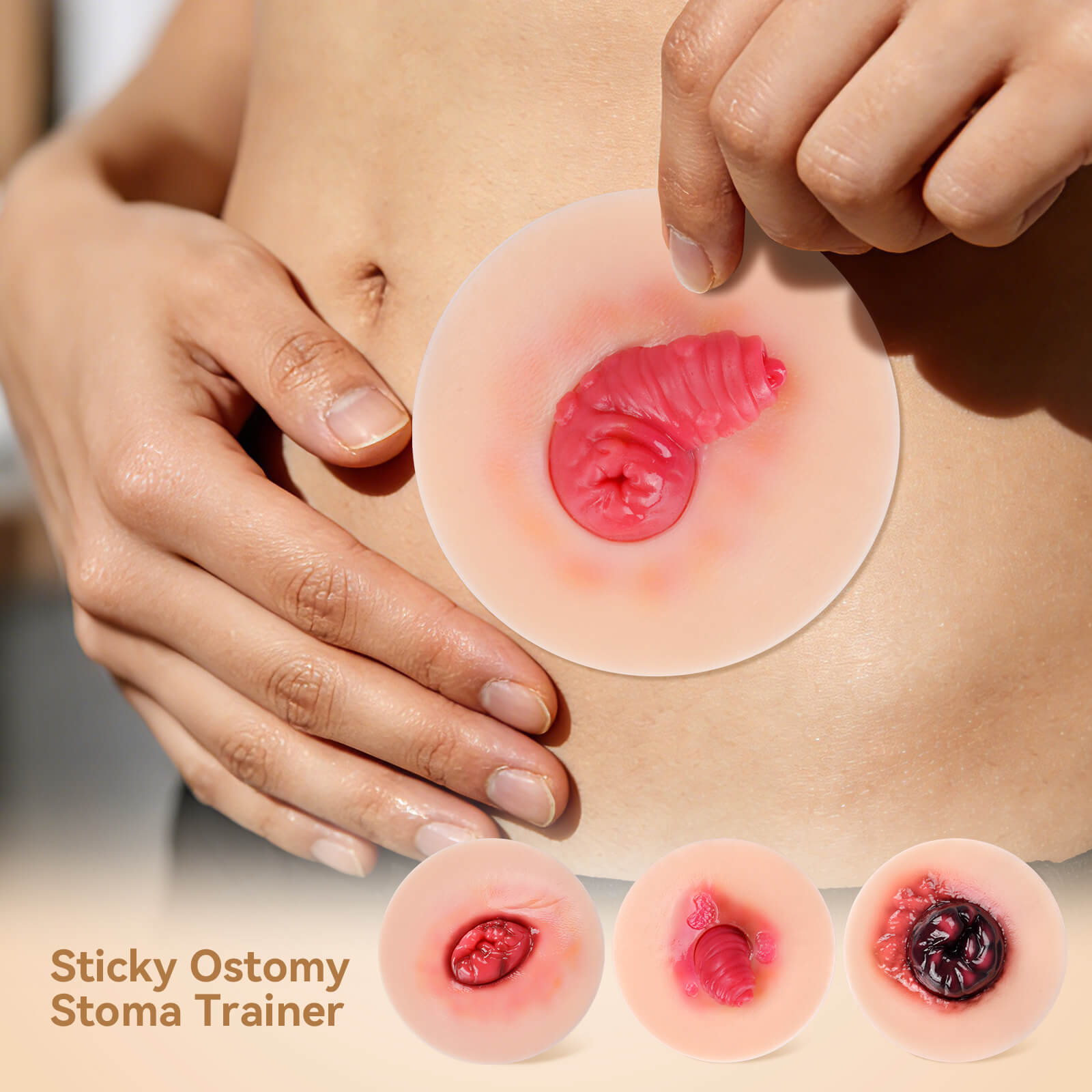 Sticky Stoma Complications Simulation Models Set