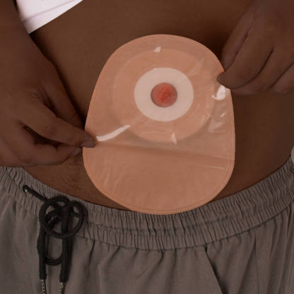 Practice Stoma Pouch Application