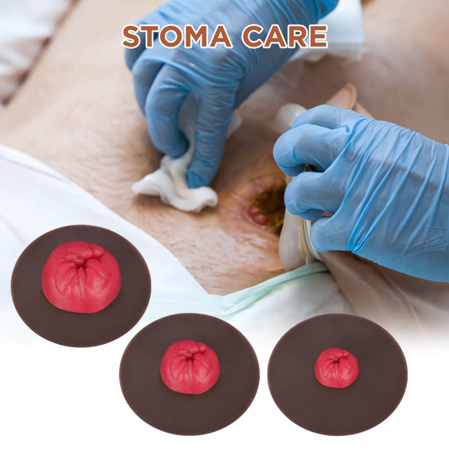 Stoma Care Practice Models Set