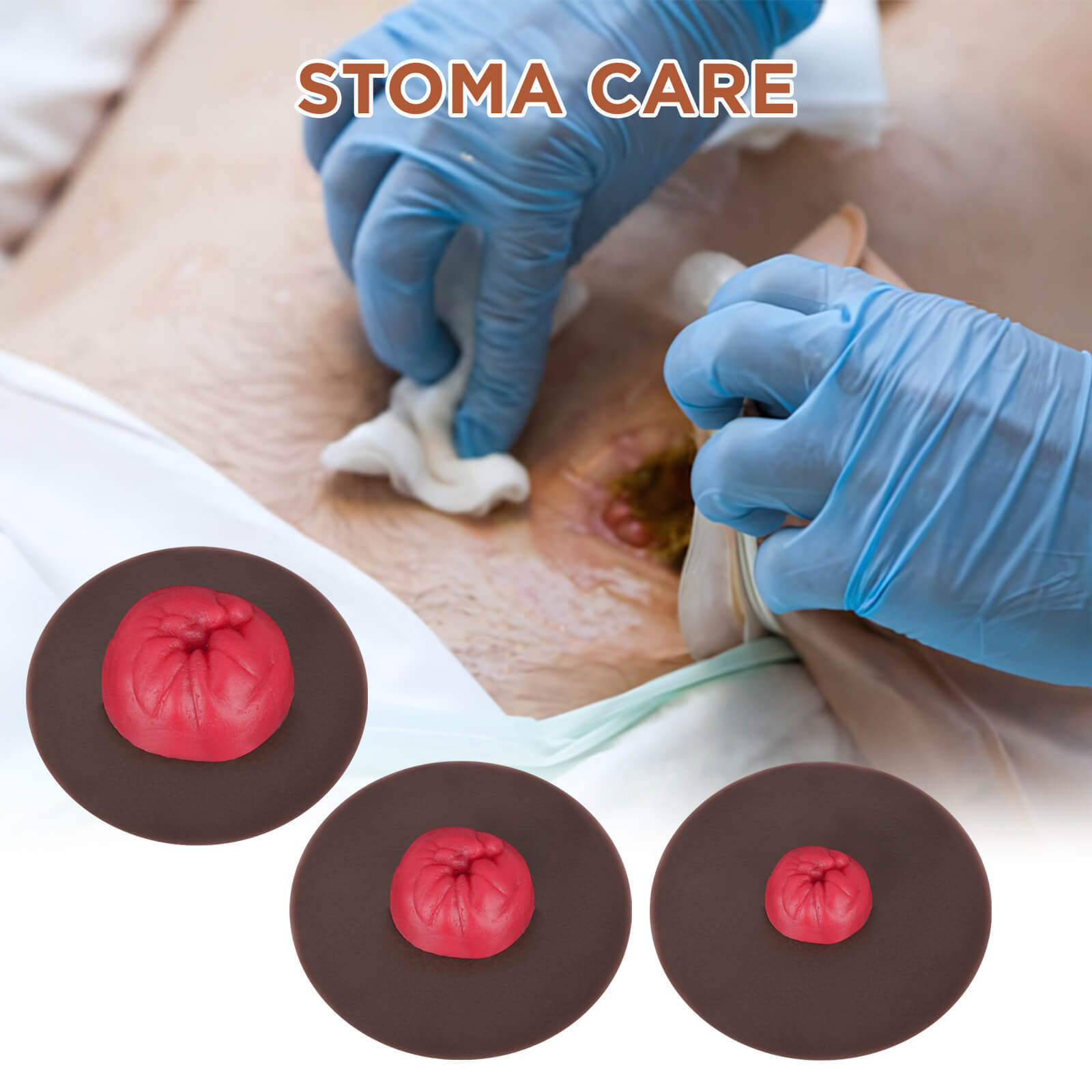 Stoma Care Practice Models Set