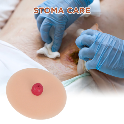Sticky Urostomy Stoma Care Training Models, Light Skin