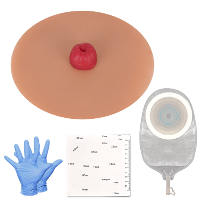 Sticky Urostomy Simulator, Tan Skin