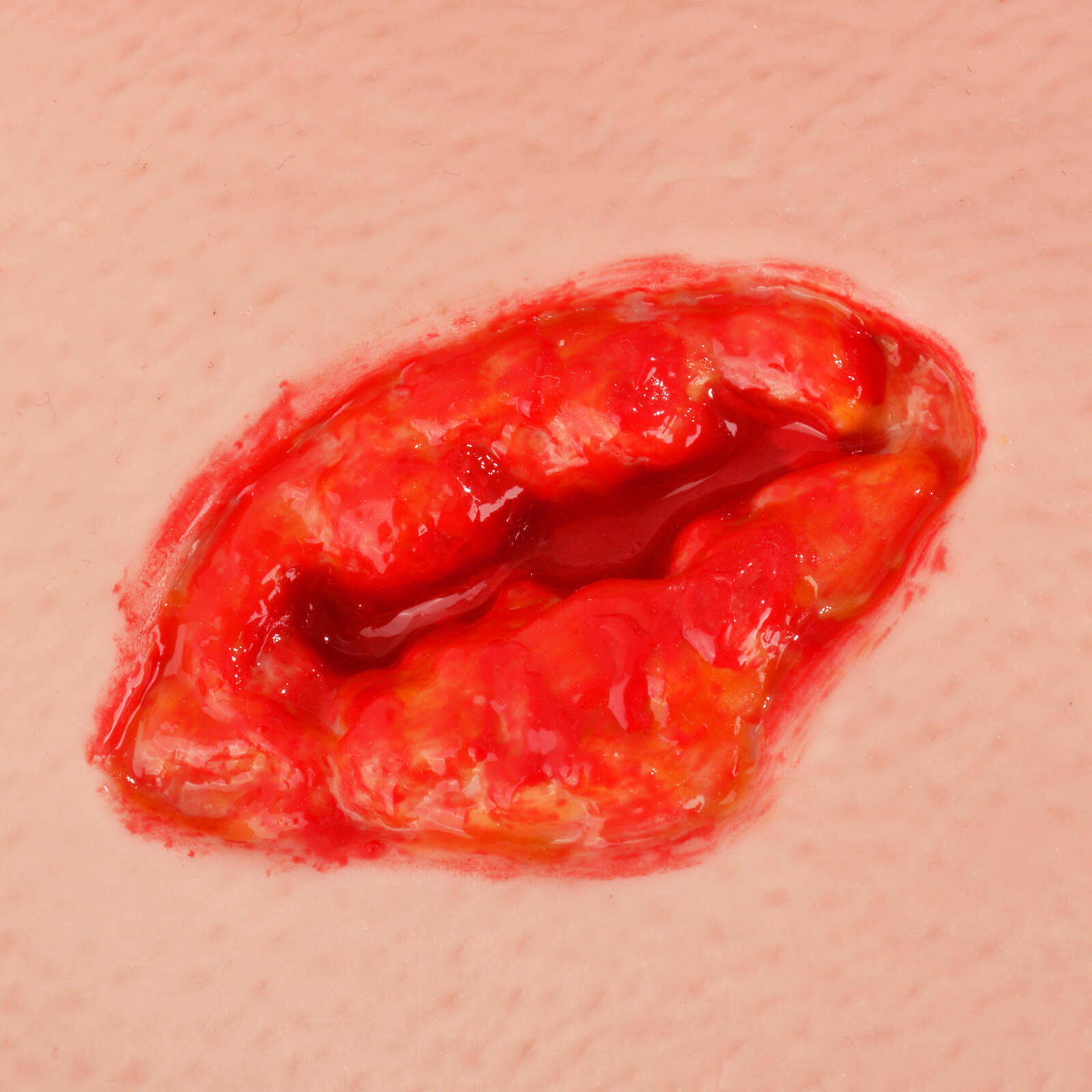 Severe Thigh Trauma Wound Packing Trainer 