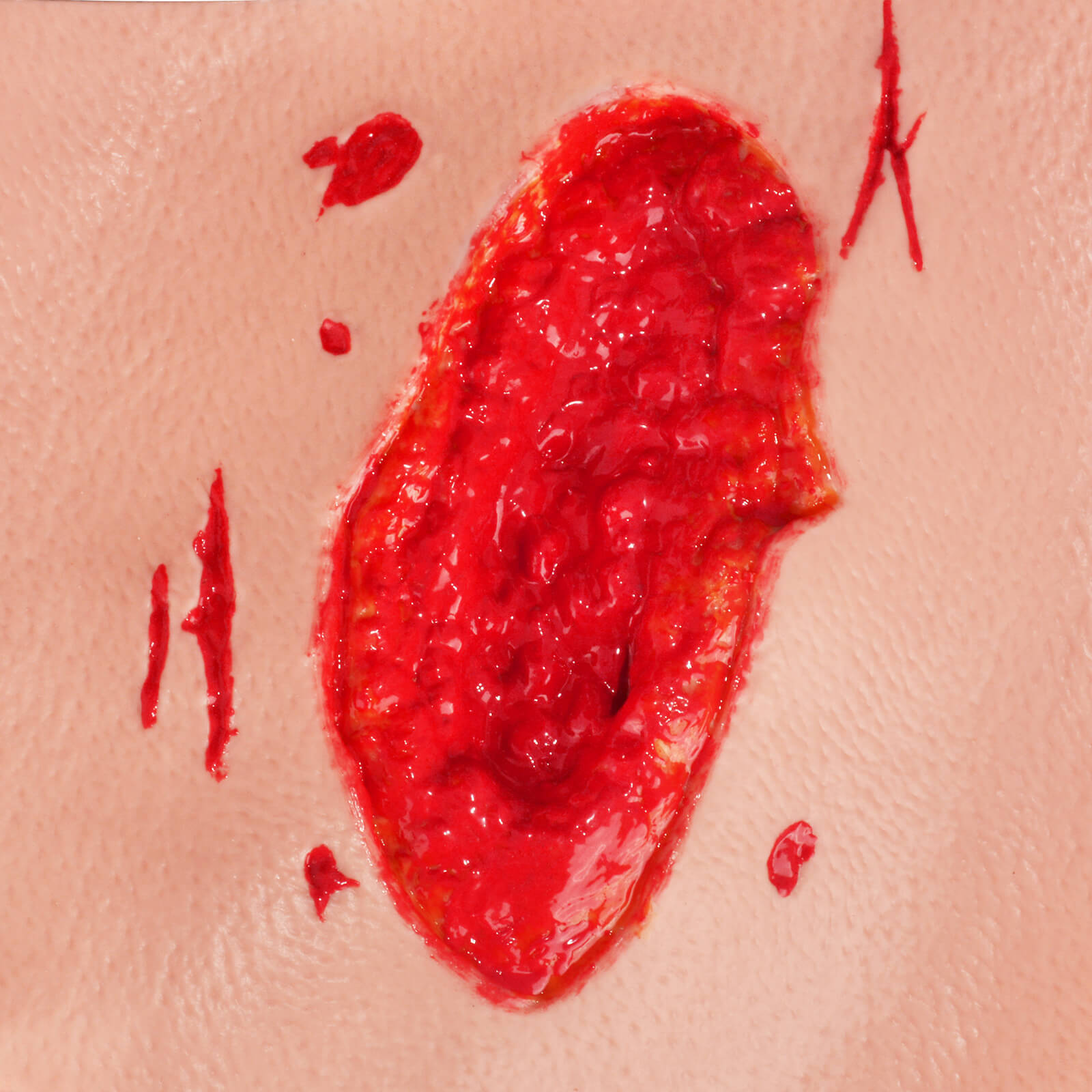 Severe Thigh Trauma Wound Packing Trainer 