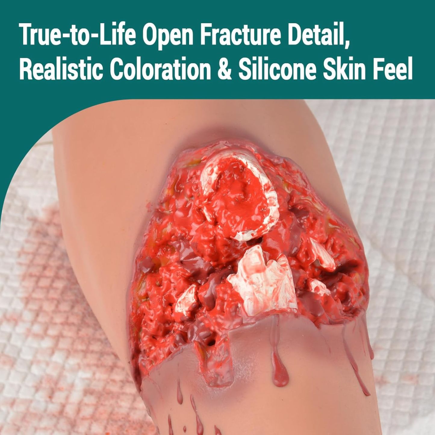 Open Fracture Leg Trauma Training Kit