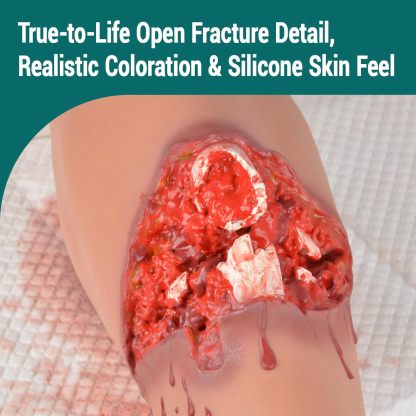 Open Fracture Leg Trauma Training Kit