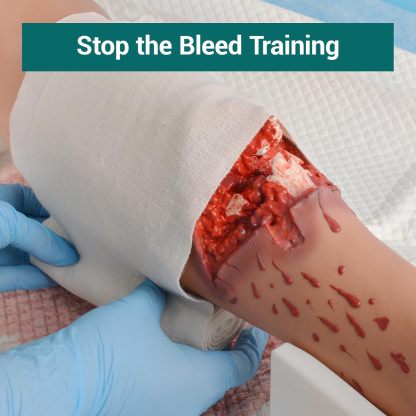 Open Fracture Leg Trauma Training Kit