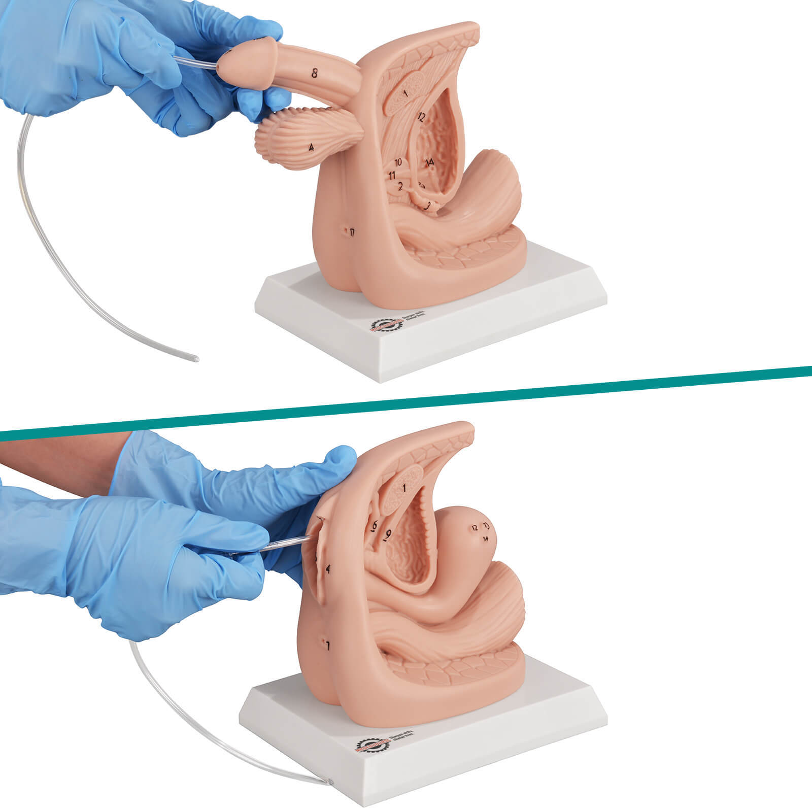 Urethral Catheterization Anatomy Display Model Set