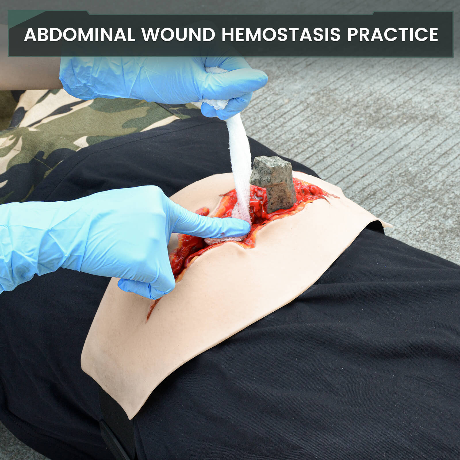 Wearable Penetrating Abdominal Trauma Trainer Kit